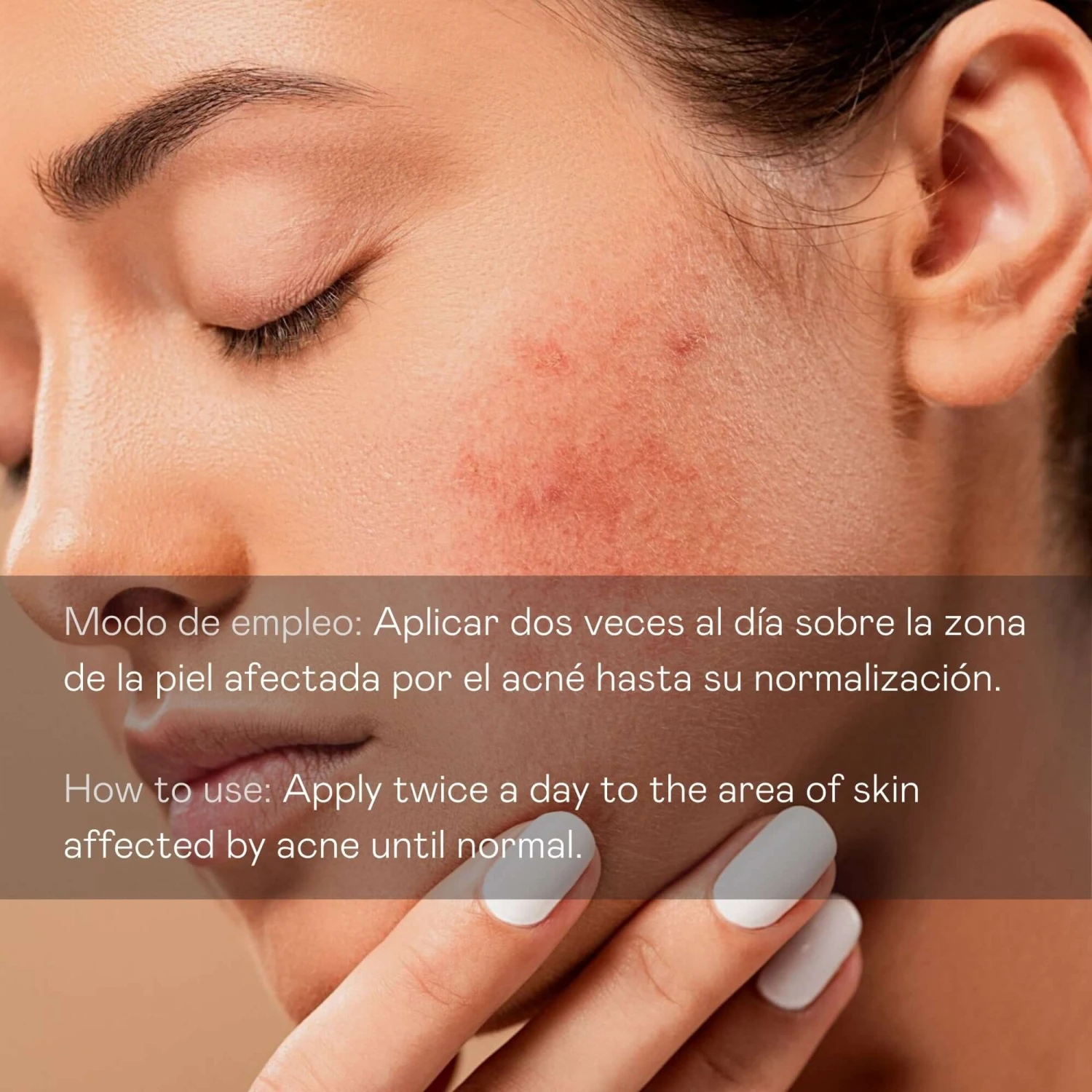 Serum Facial Antiacne Directo - 30 Ml - Imagen 4